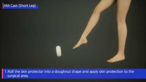 HM CAST Short Leg (3D Procedure)