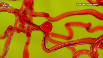 Thread-Like Robot Can Snake Through Brain’s Tiny Pathways