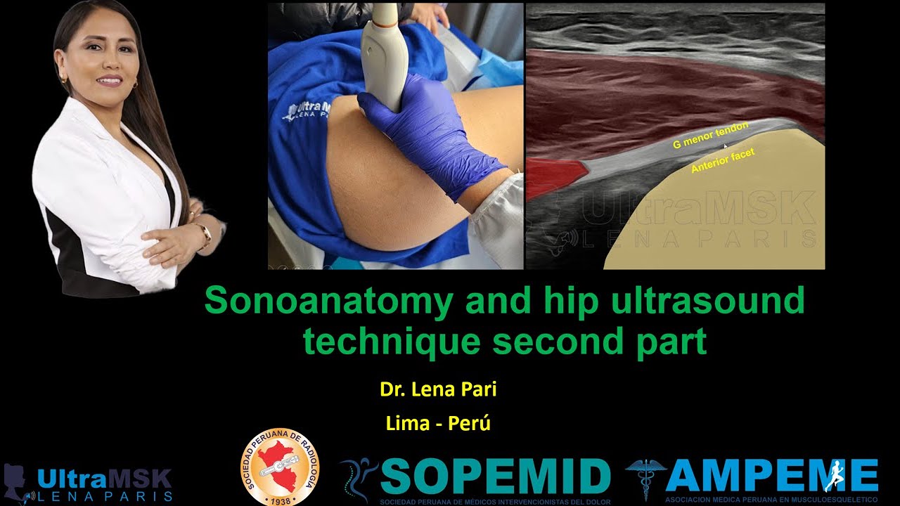 ¿Como realizar ecografía de cadera del adulto?, Segunda parte (Cara lateral). Dra. Lena Pari