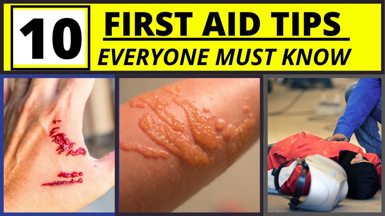 10 First Aid Tips You Must Know. YouTube