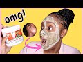 TRY THIS AZTEC HEALING CLAY MASK TO GET RID OF ACNE SCARS... 😳🤯