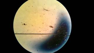Life in a Drop of Stinky Water