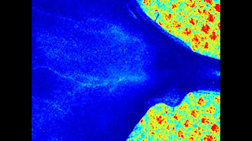 Laser Speckle Contrast Imager System - Pseudo color - Limb 1