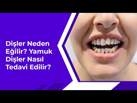 Video: Çarpık Dişleri Düzeltmenin 5 Yolu