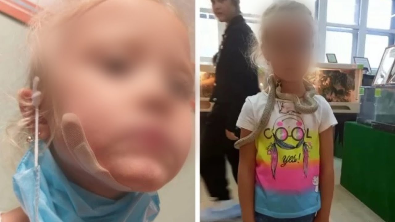 Змея вцепилась девочке в лицо. - YouTube