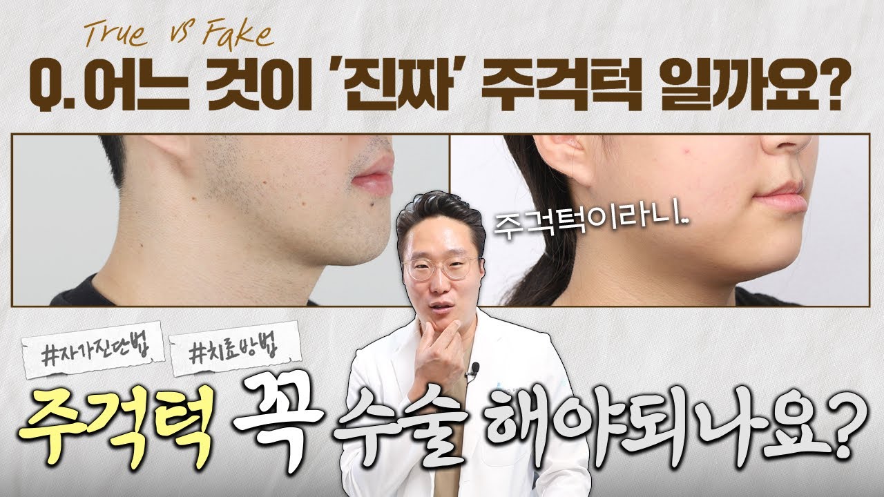 수술하지 않아도 되는 주걱턱이 있다? (Feat.가짜 주걱턱 구별법 공개) - YouTube