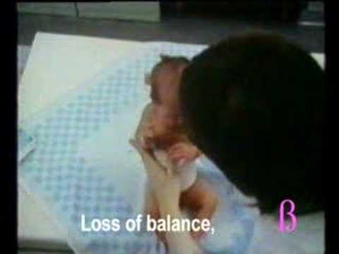 10. Moro reflex-