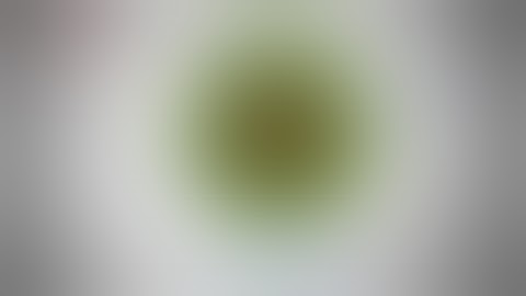 Novel Intrascleral IOL Fixation Four-Flanged Technique by Dr. Sergio Canabrava