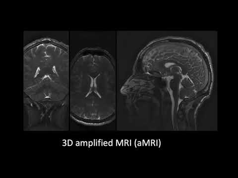3D aMRI