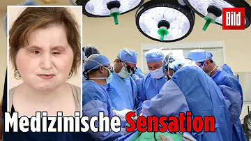 Wird das Gesicht im Alter breiter?