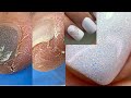 Руки кровят 🙁 Лайфхак с сухой кутикулой💅 Обработка пазух до блеска💅 Маникюр