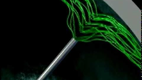 Cohesive viscoelastic for rhexis & IOL implant