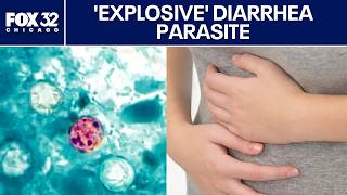 Illinois doctor explains what to know about the 'explosive' diarrhea parasite