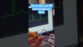 Learn to build your own electrocardiography device #arduino #arduinoproject