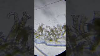 Пресноводная коловратка под микроскопом. (х50 и х125)