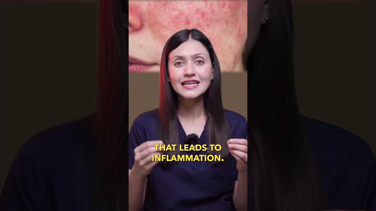 Are Seborrheic Dermatitis And Dandruff The Same Thing Dr Sarin 
