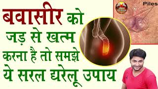 बवासीर को जड़ से ख़त्म करना है तो समझे ये सरल घरेलू उपाय! Piles Treatment At Home #JIWAN JINE KI KLA