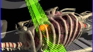 Trilogy Respiratory Gating System (2)