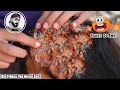 Scratching On Scalp ( Removal Dandruff Flakes ) In Long Dirty Long hair #181