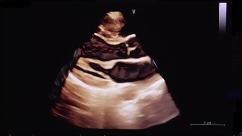 3D data set acquisition