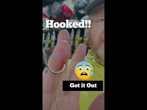 How to easily remove a hook from hand or body (painless method) 