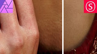 Remove Goosebumps EASY - Affinity Photo Tutorial