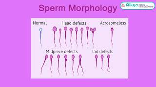 Decoding Male Infertility: Insights from Dr. Sunil