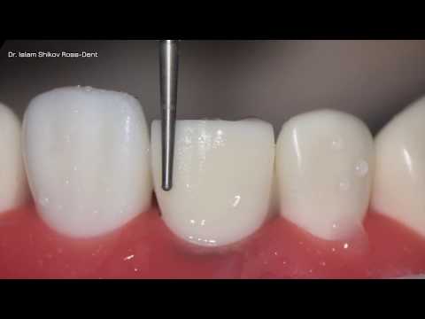 Цикл препарирование Видеоурок 3