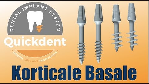Quickdent Korticale Basal Implant| Quickdent Dental Implant | basal implantology | immediate loading