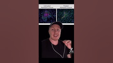 Ultrasound waves restore brain function (in mice)