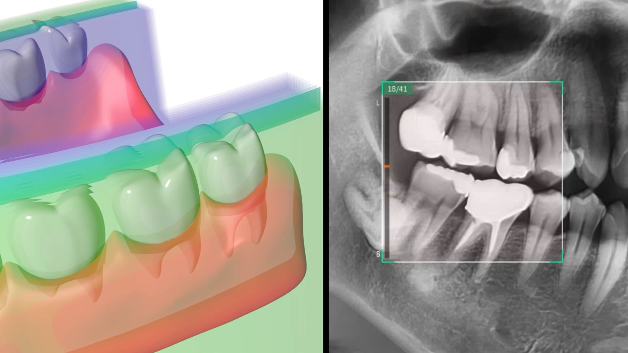 INSIGHT NAVI from VATECH Korea