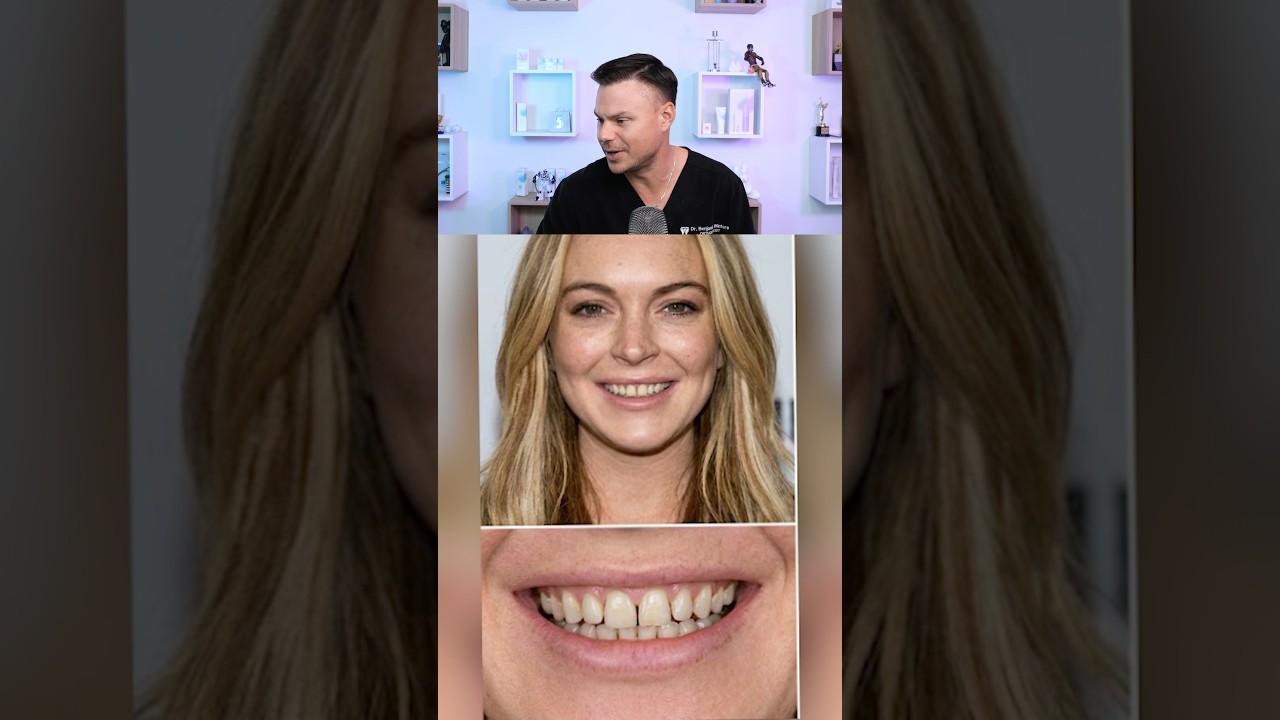 Dentist Reacts To Lindsay Lohan’s Smile Transformation! 😁🦷