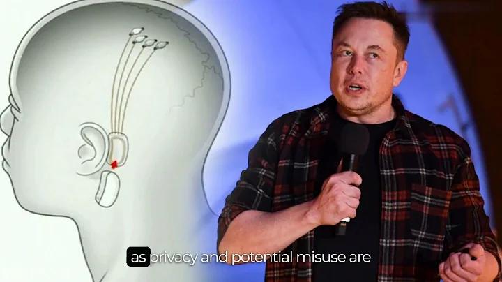 🧠 Exploring Neuralink Merging Minds with Technology 🌐#ytshorts #elonmusk #neurolink