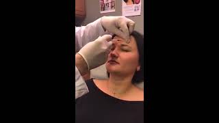 Botox Live!!!