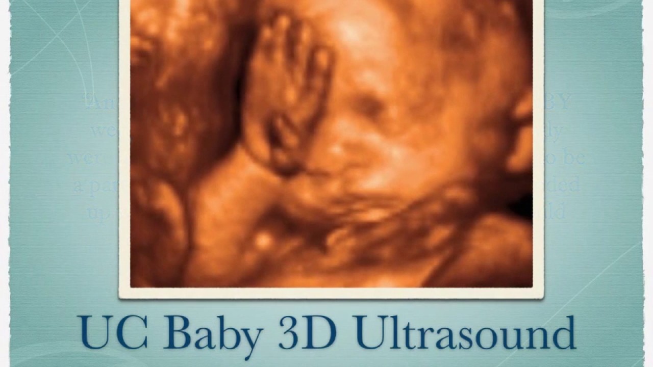 UC Baby 3D Ultrasound Images &amp; Client Reviews YouTube