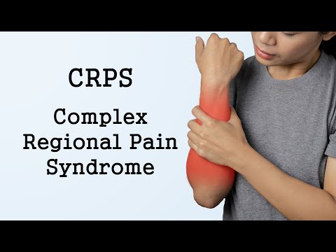 Video: Smertereduktion Ved At Inducere Sensorisk-motorisk Tilpasning I Kompleks Regional Pain Syndrome (CRPS PRISMA): Protokol Til Et Dobbeltblind Randomiseret Kontrolleret Forsøg