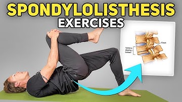 5 Exercises for Lumbar Spondylolisthesis