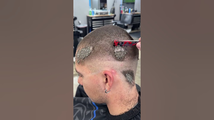 Ce Coiffeur doit Sauver son Client des Poux !✂️