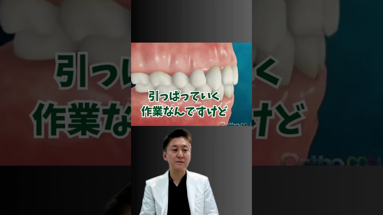 効率よく歯を動かしていきます! #歯列矯正 #蒲田 #歯医者 #矯正