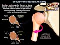 Shoulder Dislocation Anatomy - Everything You Need To Know - Dr. Nabil Ebraheim