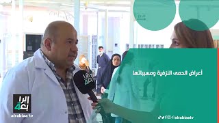 أعراض الحمى النزفية ومسبباتها.. طبيب استشاري في مستشفى الشيخ زايد يبينها عبر 