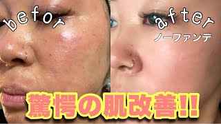 ゼオスキン】皮剥けから1ヶ月徹底レビュー!!!!毛穴引き締まりが神