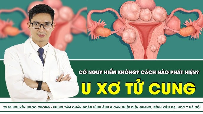 Image hình ảnh con người hình ảnh con người hình ảnh con người hình ảnh con người Nguyễn Ngọc Trung - U xơ tử cung có nguy hiểm không? cách nào phát hiện? | SKĐS - YouTube