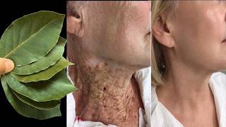 Bu Bi̇tki̇ Her Şeyi Iyileştiriryor Botokstan 1000000 Kat Daha Güçlü Sihirli Yağ