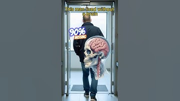This man lived with only 10% of his brain