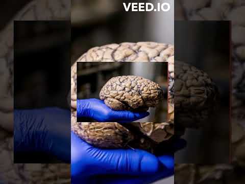 هل تعلم ان الدماغ يأكل نفسه 