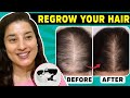 This GrowBand Pro Will Speed Up Your Hair Growth | Hair Care Tips | Rachna Jintaa