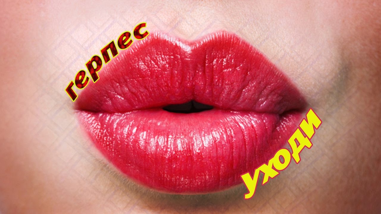 Как избавиться от герпеса (убрать проявление герпеса) лайфхак - YouTube