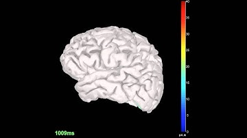 Luriann Total Protection Serum: Dynamic Process of Cognitive Activity