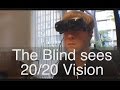 The Legally Blind Seeing 20/20 Vision For The First Time